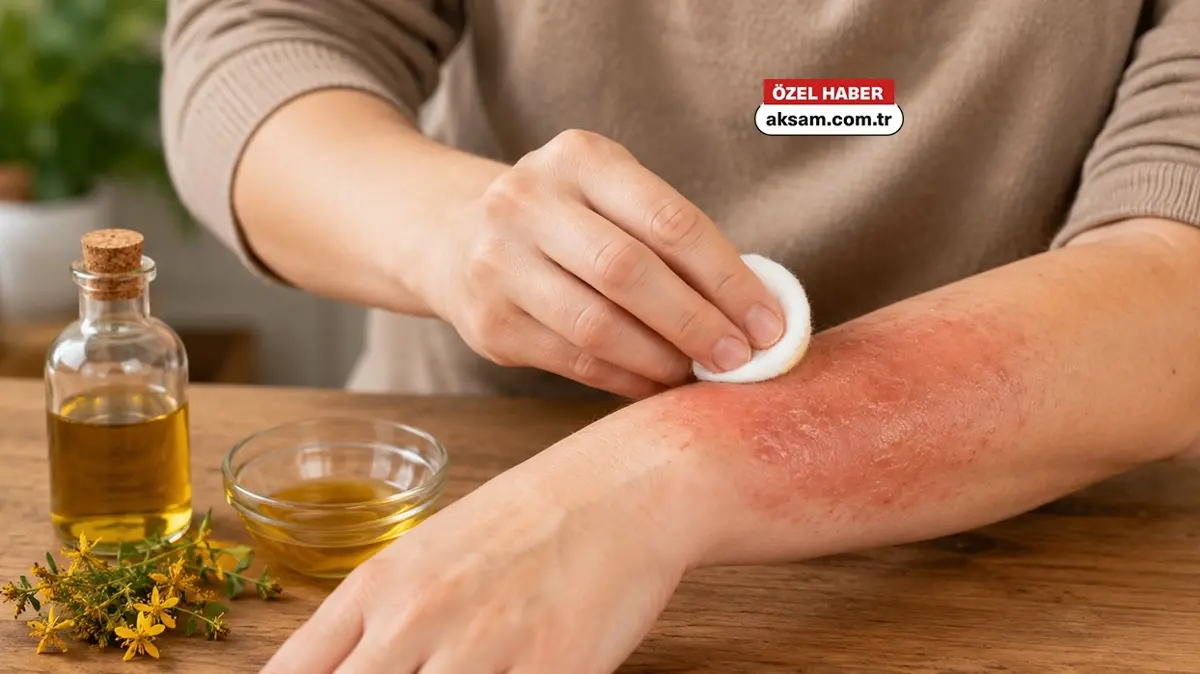 Egzamalı cilde ne sirke ne kantaron yağı sürmeyin! Uzmanı egzamadan kurtaran 3 dakika kuralını açıkladı