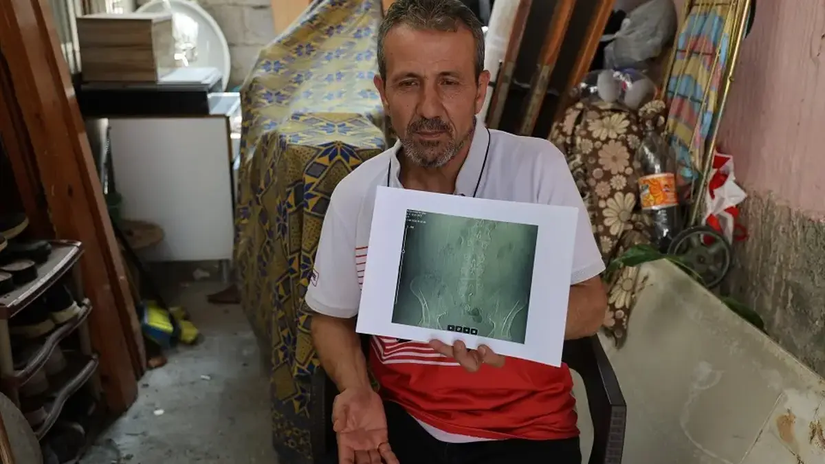 Adana'da akılalmaz ihmal: Ameliyatta belinde "panç" unutuldu