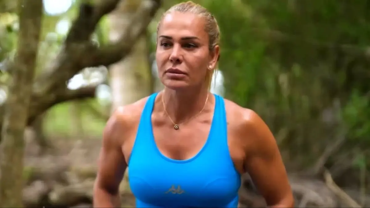 Survivor Nagihan estetik yaptırdı! Son hali şoke etti...