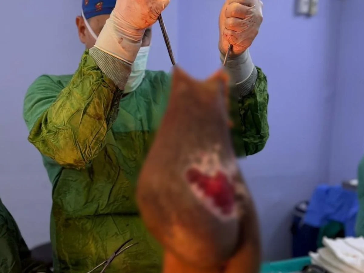 Aydın'da yaşayan kadının karnından 40 kilogram kitle çıkarıldı