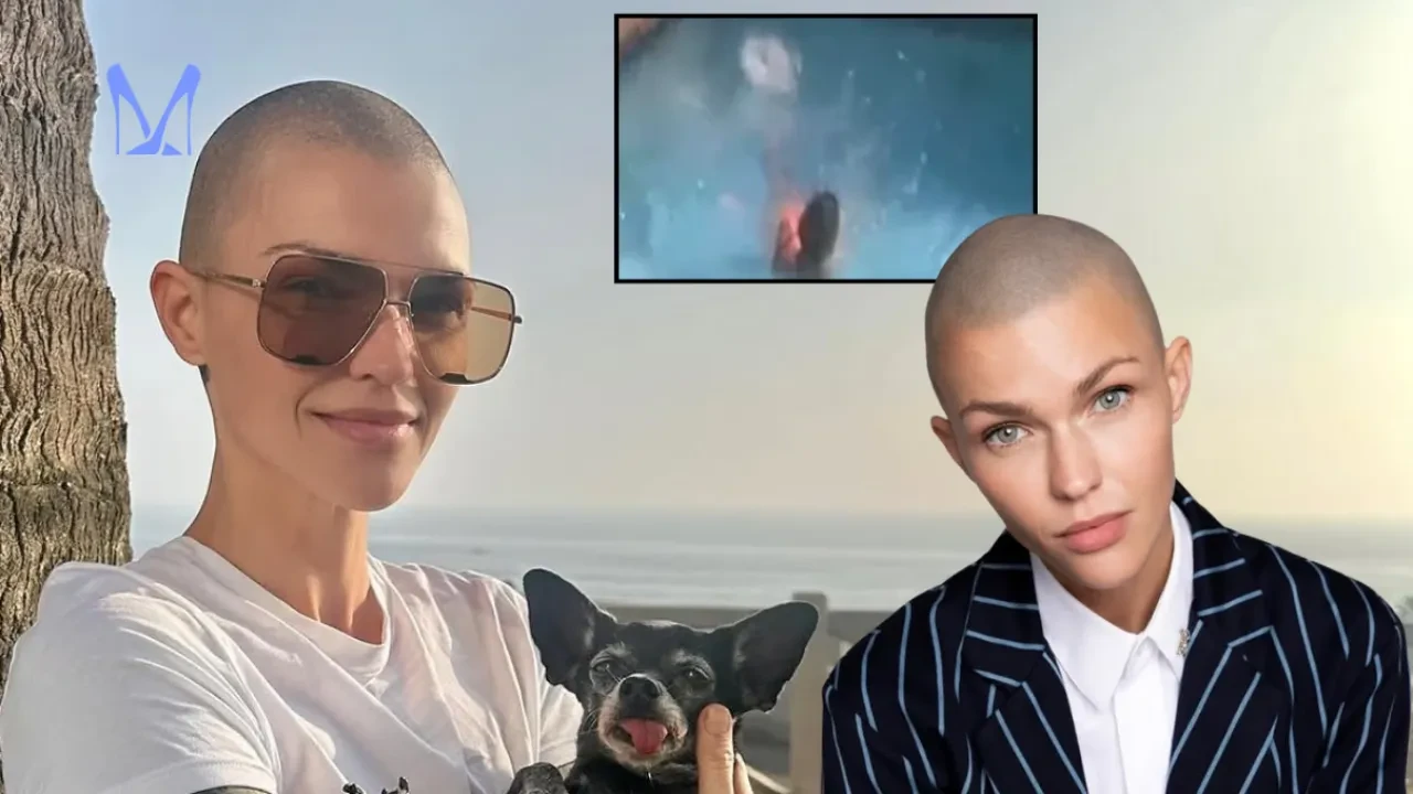 Oyuncu Ruby Rose’tan kötü haber geldi! Evinin bahçesinde yaşadığı kaza korkuttu