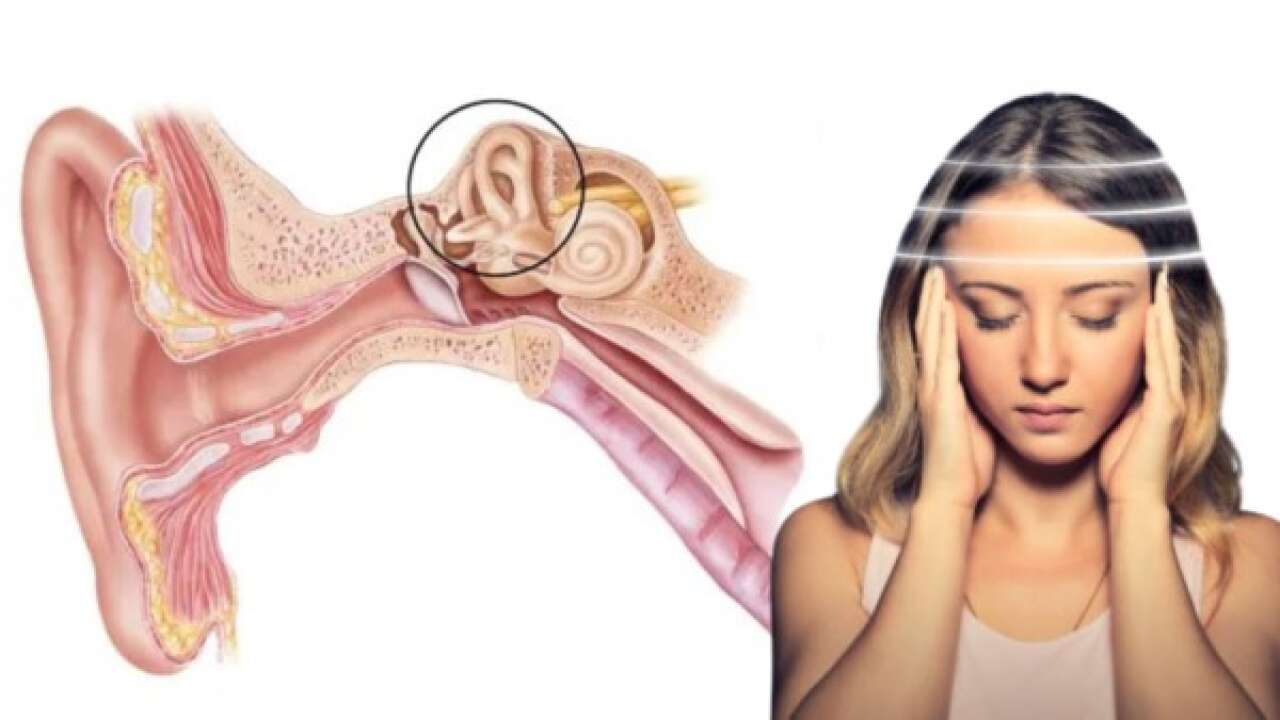 Vertigo nedir? Baş dönmesinin nedenleri ve tedavi yöntemleri