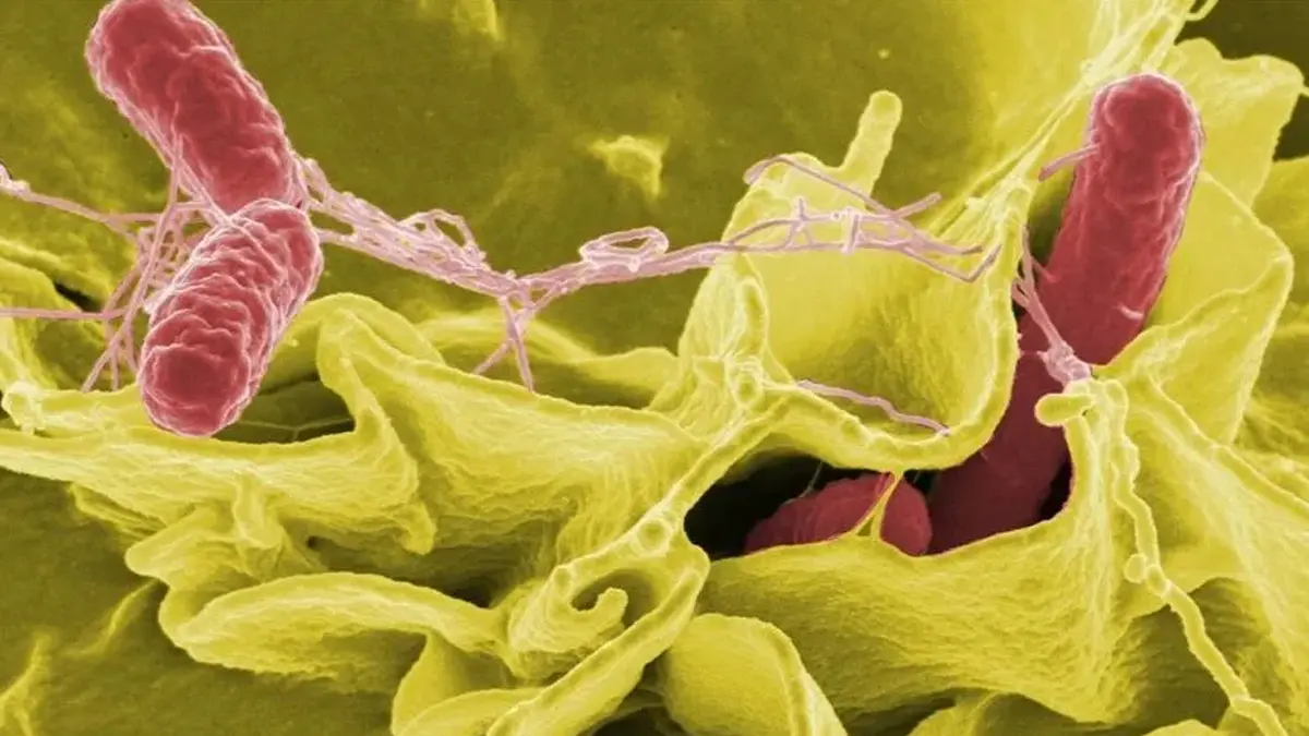 Fast food tüketiminden kaçınma çağrısı! 11 salmonella vakası tespit edildi