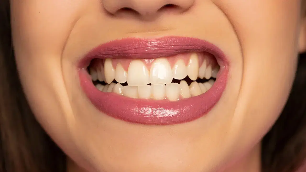 Diş aşınması ve boyun tutulması yaşayanlar dikkat!
