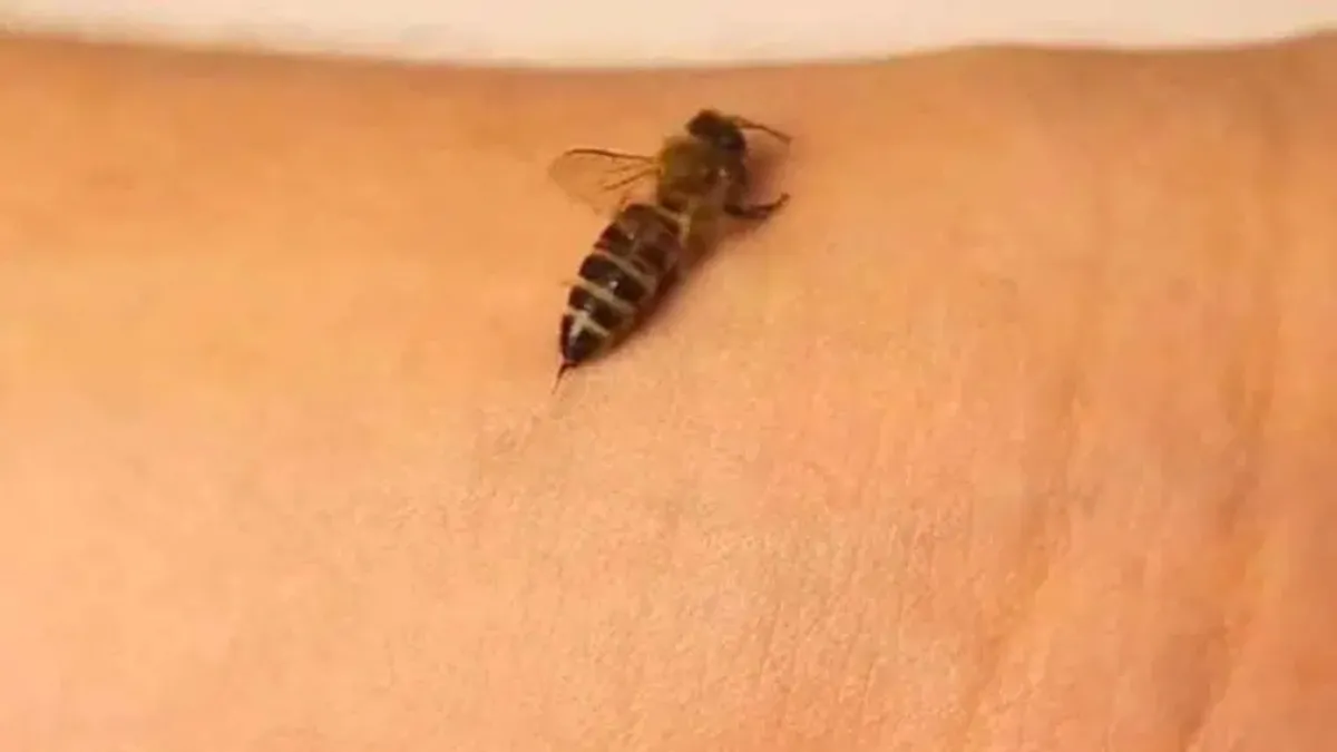 Arı soktu 2 gün sonra hayatını kaybetti! Uzmanlar o tehlikeye karşı uyarıyor