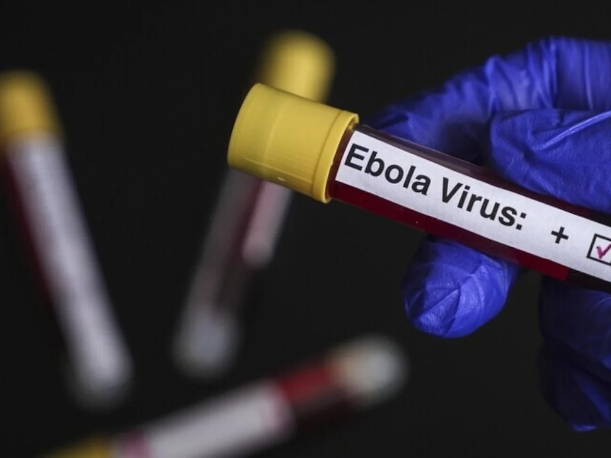 ABD'den Ebola uyarısı: Tarihin en ölümcül seviyesine ulaşabilir