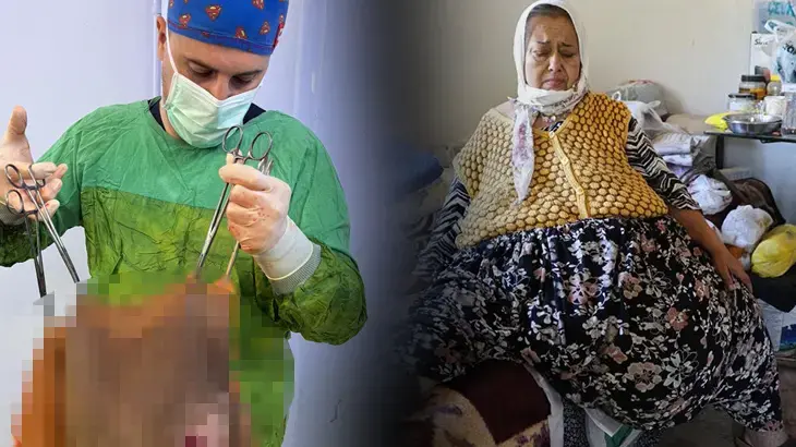 Karnından çıktı, doktorlar gözlerine inanamadı!