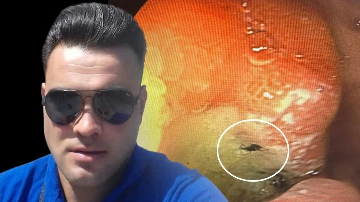 Mide ağrısı şikayetiyle doktora gitti, hayatının şokunu yaşadı! Sebebi böcek çıktı... 'Aklımıza gelmeyen şey başımıza geldi'