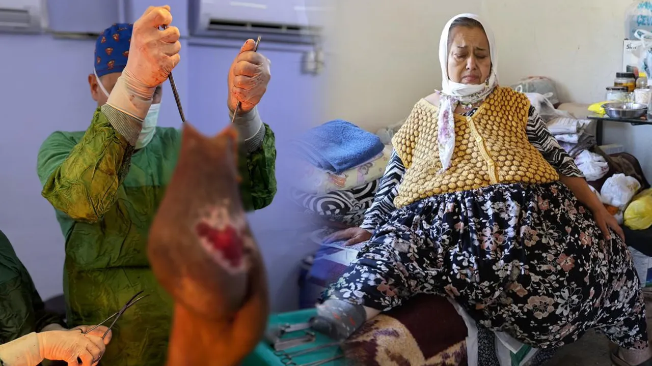 Yatağa mahkum olmuştu! Karnından tam 40 kilogram kitle çıkarıldı