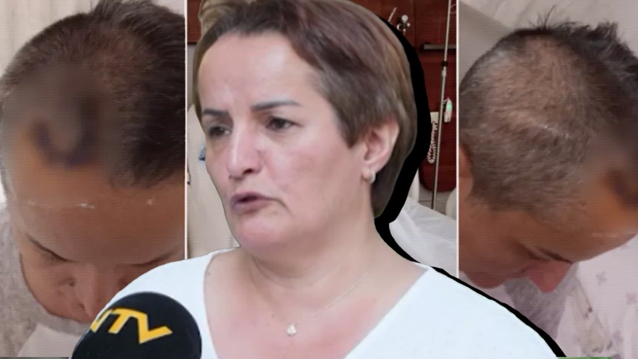 Dişini çektirmek için kliniğe gitti, hayatı kabusa döndü! İmplant sonrası beyin ameliyatı geçirdi