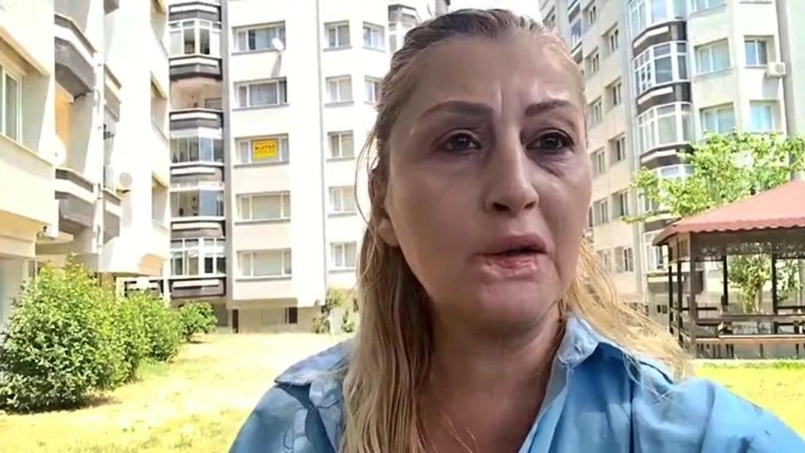 Güzelleşmek isterken kabusu yaşadı: Hukuk mücadelesi 7 yıldır sürüyor