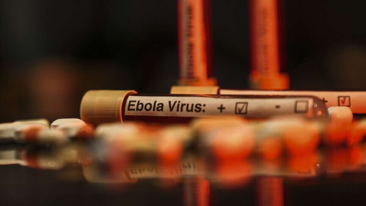 DSÖ’den Ebola alarmı: Uganda’da vaka sayısı 19’a yükseldi