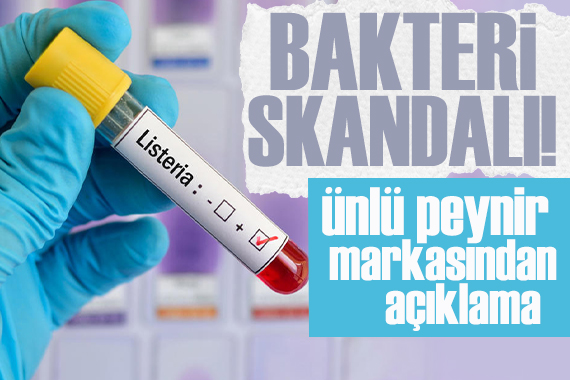 Ünlü peynir markasından “listeria bakterisi” açıklaması: Bir parti ürün piyasadan çekildi
