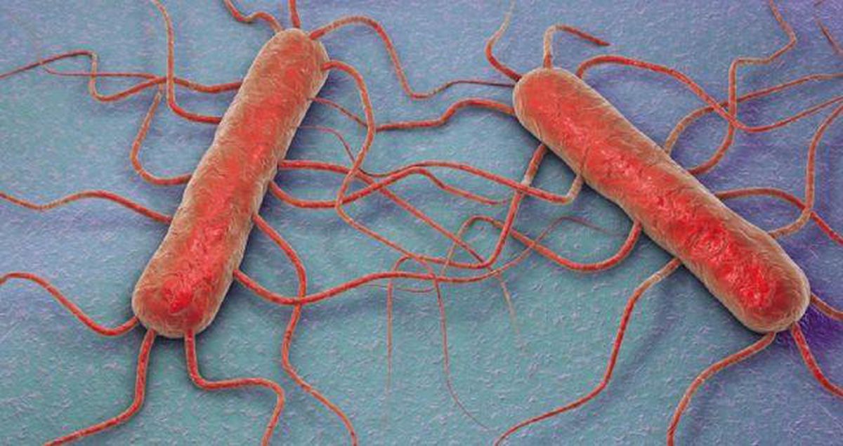 Listeria bakterisi çıkan marka hangisi? Listeria bakterisi nedir, nasıl oluşur? Listeria bakterisi ne yapar, nelerde bul..
