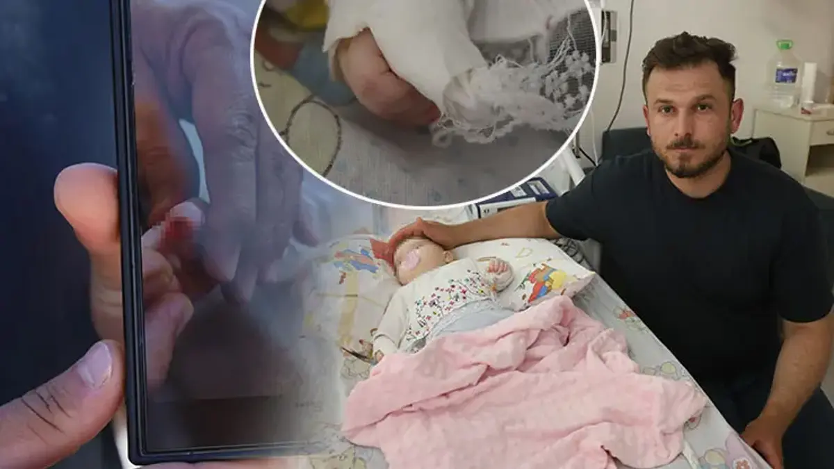 Hastanede korkunç olay! 5 aylık bebeğin parmağı sargı kesilirken koptu