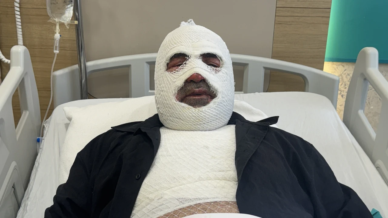 Kaputu açtı, hastanelik oldu: Ben yandım, siz yanmayın