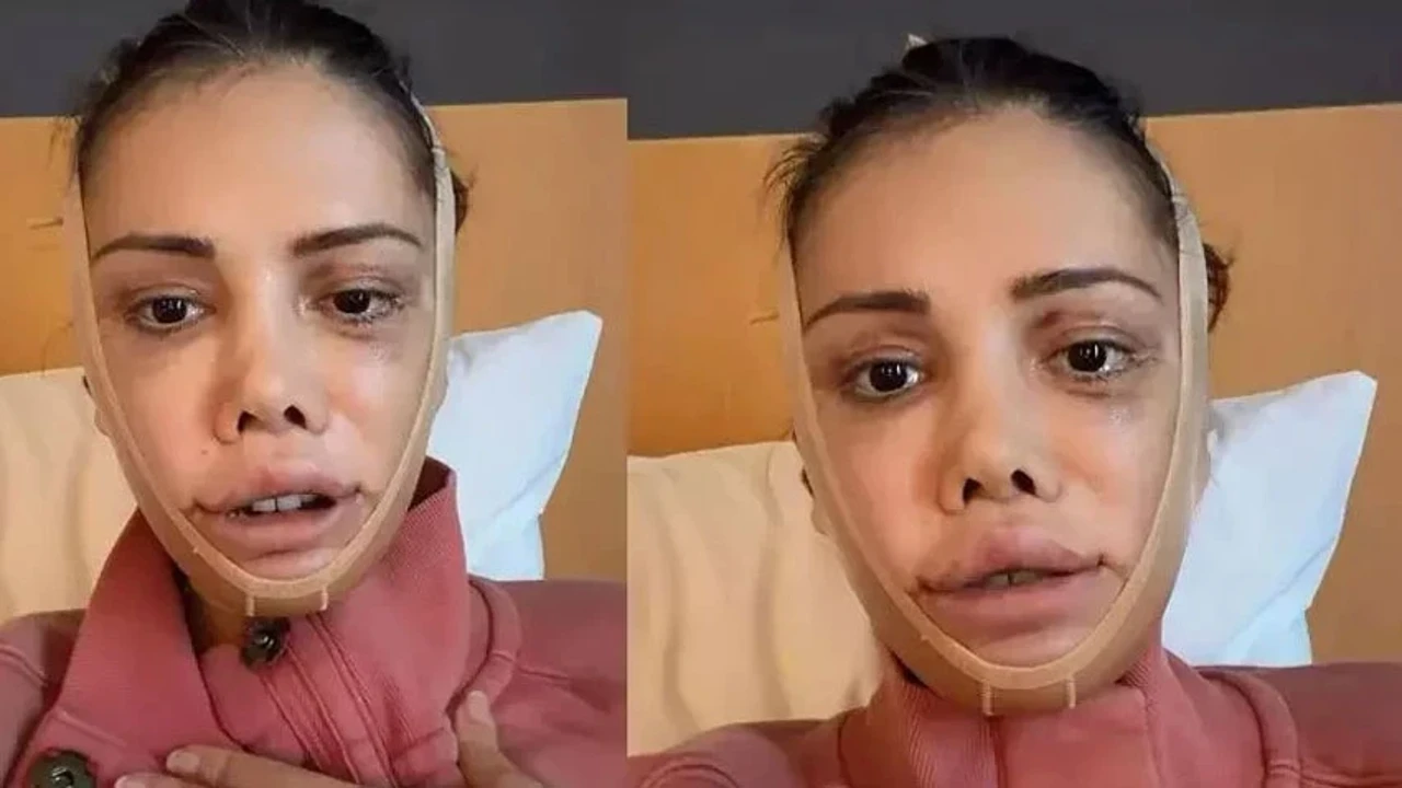 Yüz nakliyle gündemdeydi: Didem Ceran takipçisinin yorumuna ateş püskürdü