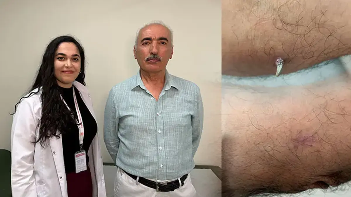 Dirseğinde 'küçük bir yara' sandı… Gerçek bambaşka çıktı: 'Geçmeyen yaraları ihmal etmeyin'