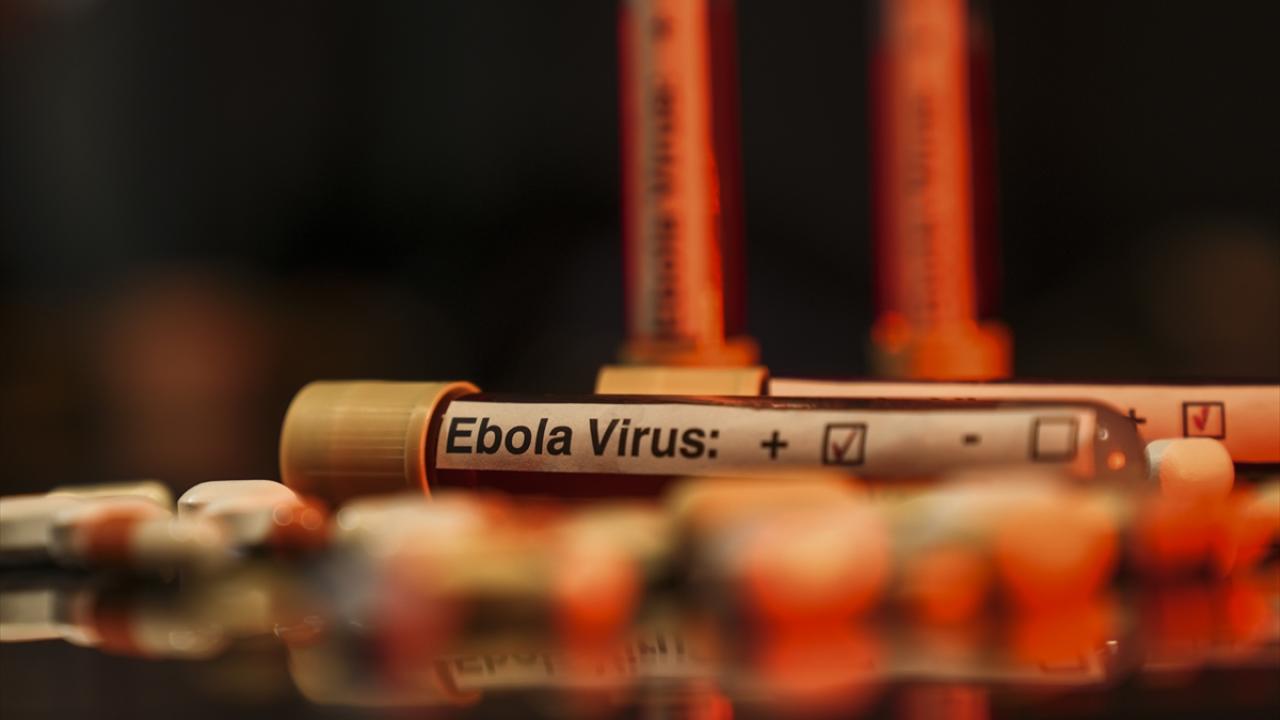 ABD'den Ebola uyarısı: Tarihin en ölümcül seviyesine ulaşabilir
