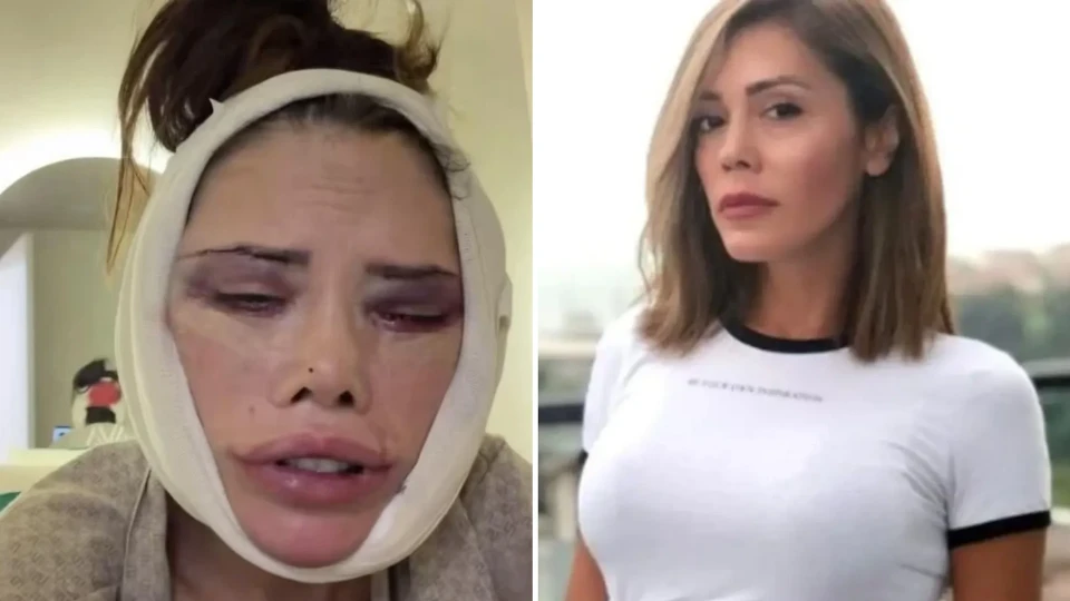 Didem Ceran ikinci kez ameliyat masasına yattı: Gözyaşları içinde "Doktorları dava edeceğim" diyerek isyan etti