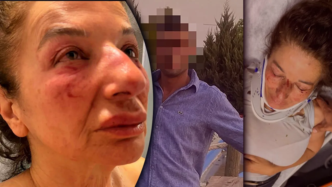 Kan donduran olay! Eczacıya ‘yardım’ bahanesiyle darp! Kemerle boğmaya çalıştı
