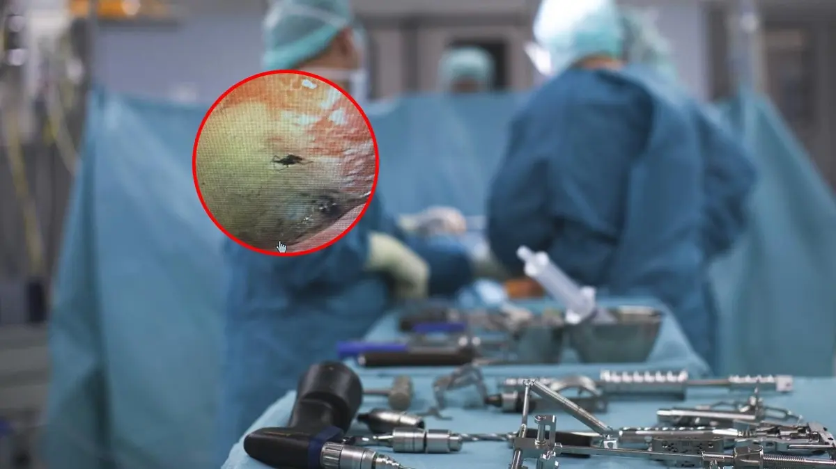 Doktorlar bile gözlerine inanamadı! Aklımıza gelmeyen başımıza geldi