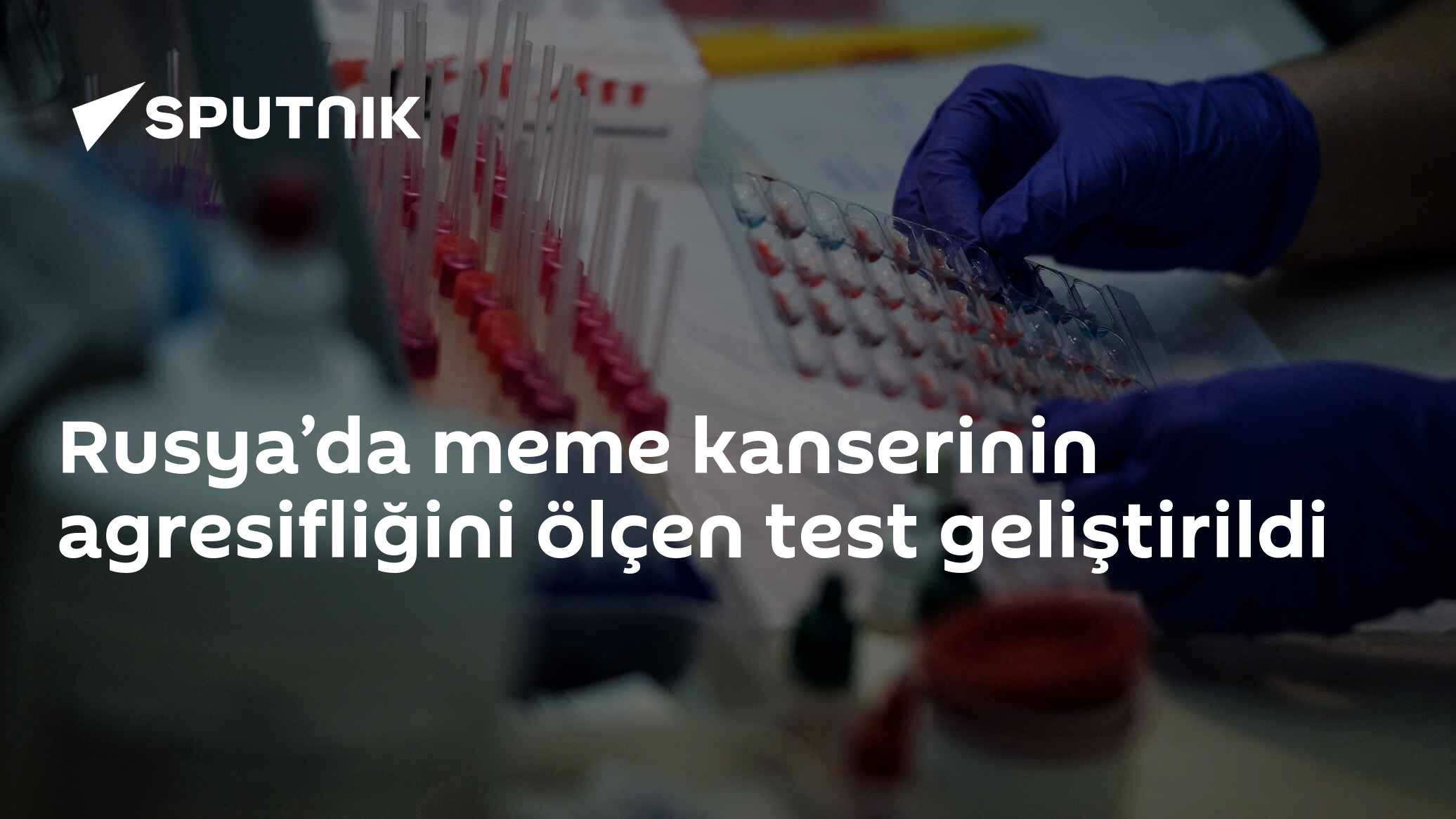 Rusya’da meme kanserinin agresifliğini ölçen test geliştirildi