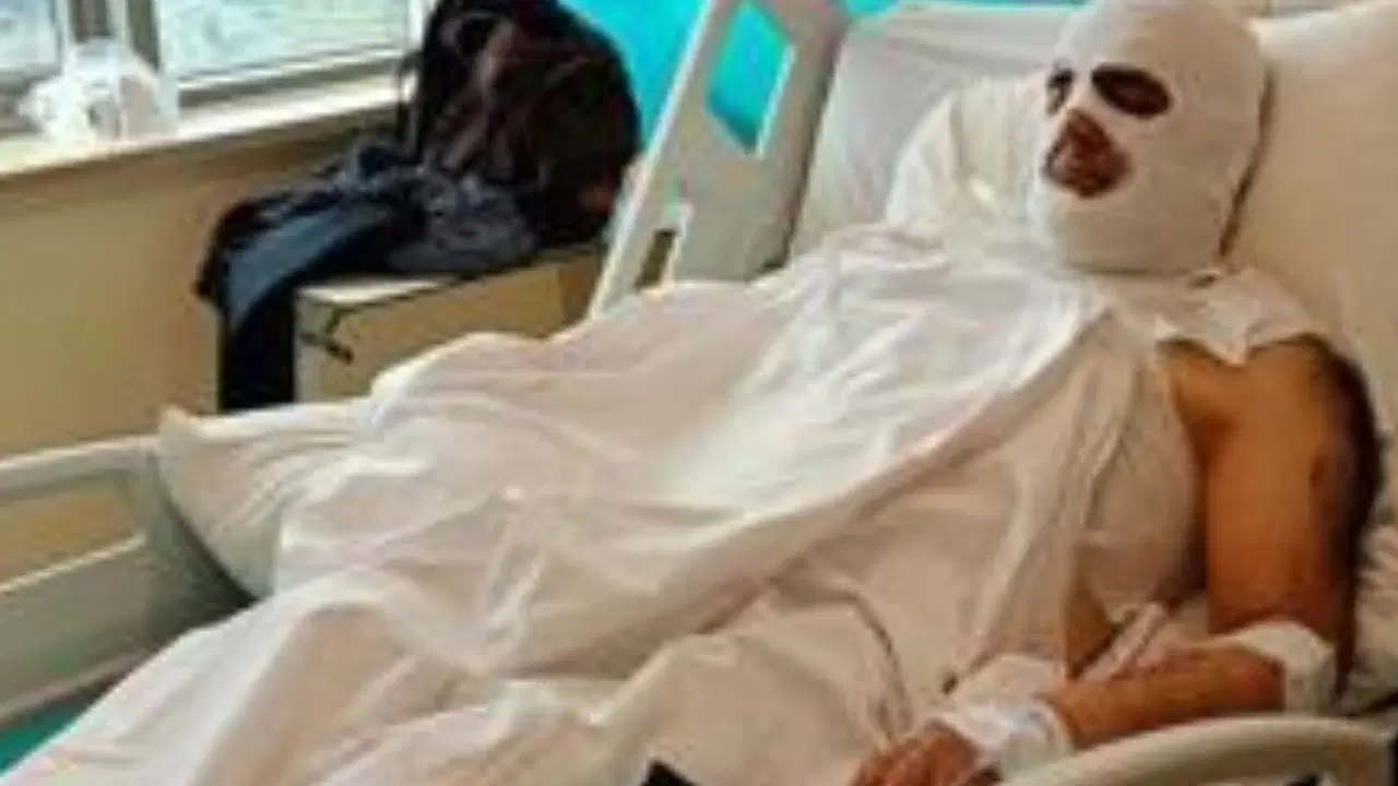 İnşaatta korkunç ihmal: Ölümden dönen işçinin sağ koluna deri nakledildi