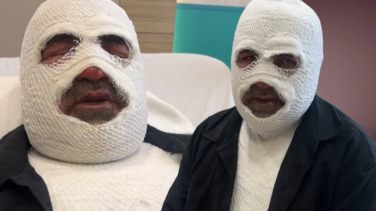 Araba sahipleri dikkat! Kaputu açınca hayatının şokunu yaşadı