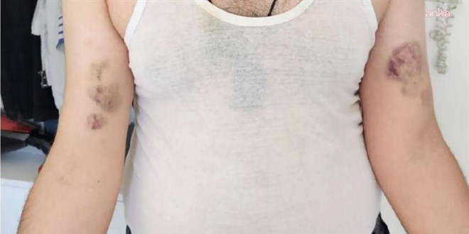 Kahramanmaraş'ta kamu mühendisine amirlerinden darp iddiası