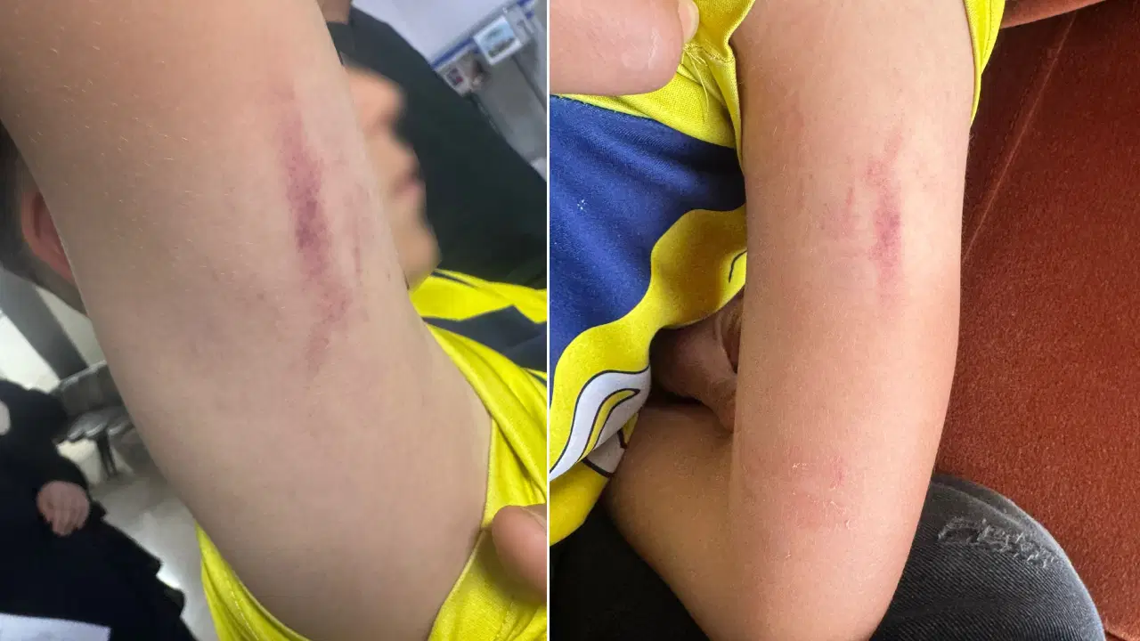 10 yaşındaki çocuk tartıştığı çocuğun annesi tarafından darbedildi: Aile şikayetçi oldu