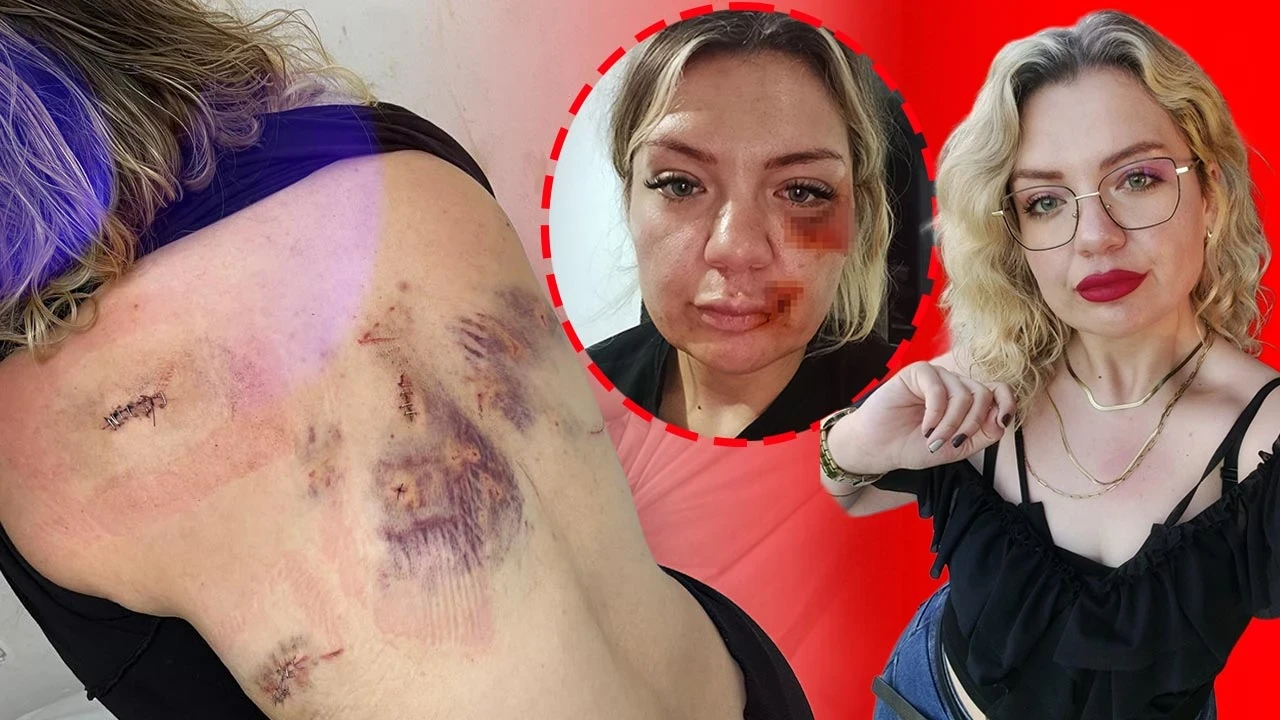 7 Kez Uzaklaştırma Kararı Aldırdı! Eski Sevgilisinin Bıçaklı Saldırısına Uğradı: 'Bıçak Kırılmasaydı Yaşama Şansım Yoktu'