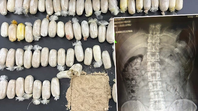 Şüphe üzerine durduruldular: 2 İranlının midesinden uyuşturucu çıktı