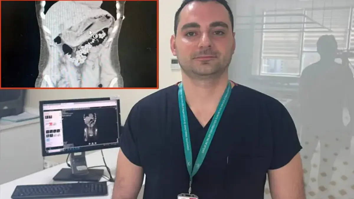 Zayıflamak uğruna kendine yaptığına doktorlar bile inanamadı!