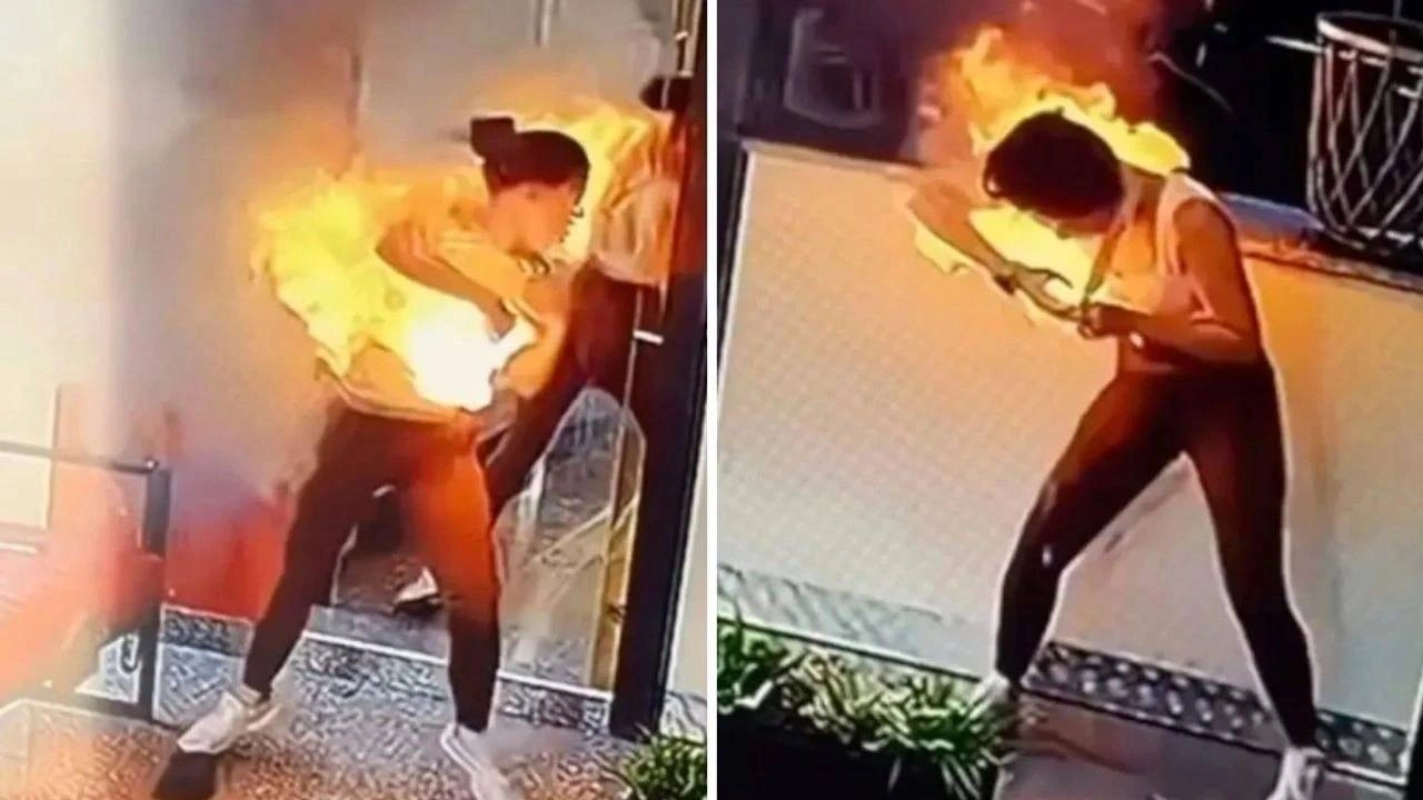 Çantasındaki cihaz patladı, bir anda alevler içinde kaldı! Genç fenomen ölümden döndü