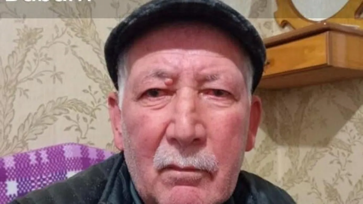 Sakarya'da börekçide darbedilmişti: 3 ay sonra yaşamını yitirdi!