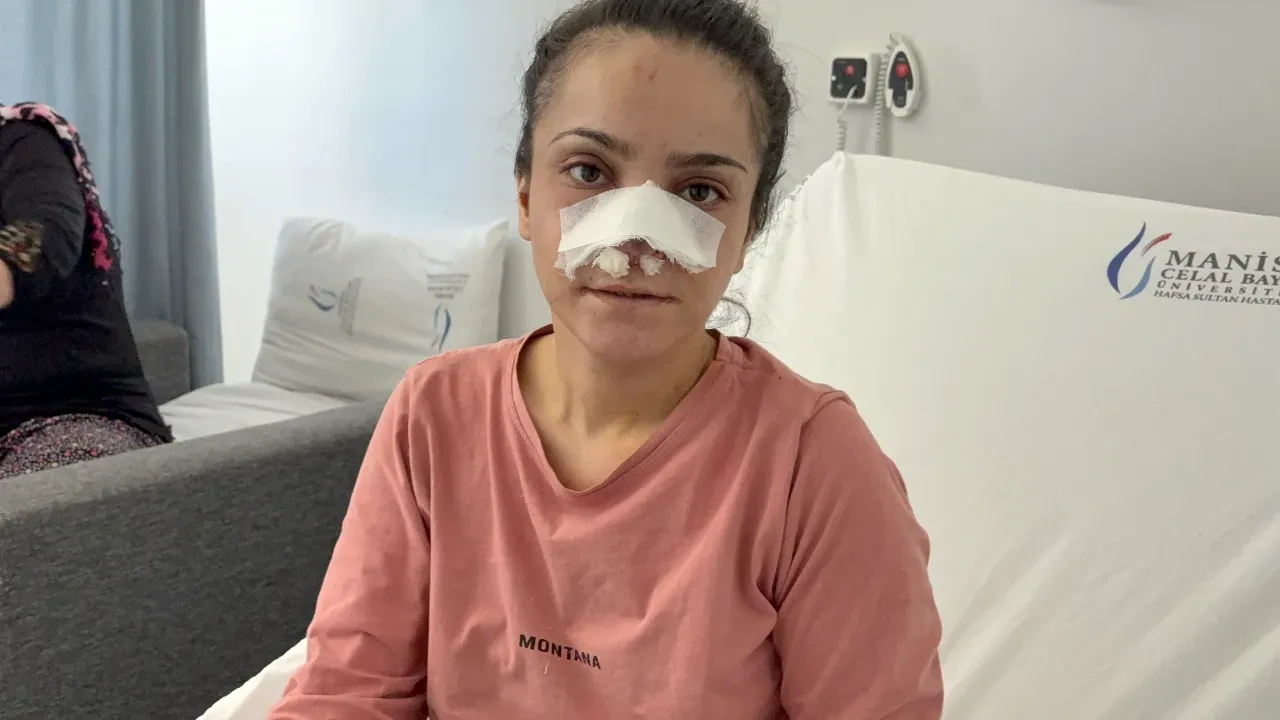 İki çocuğunun gözü önünde korkunç saldırı! Genç annenin burnunu ısırarak kopardı