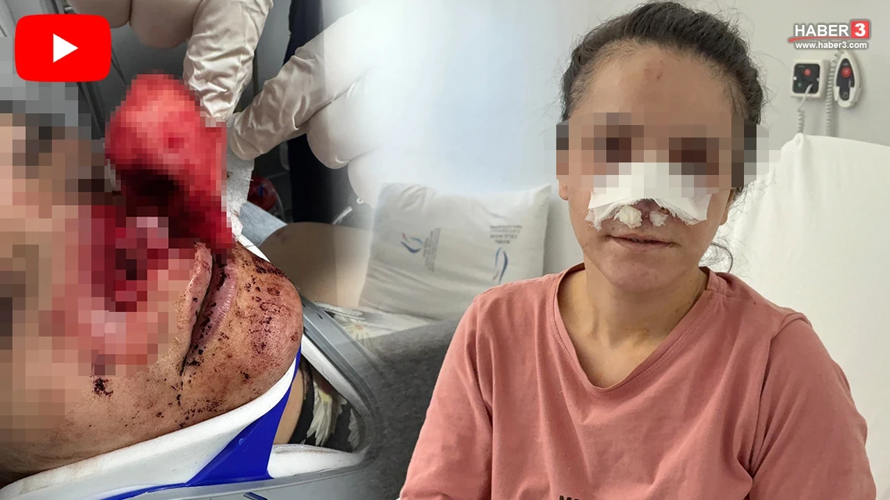 Burnu koparılan genç kadın yaşadığı dehşeti anlattı