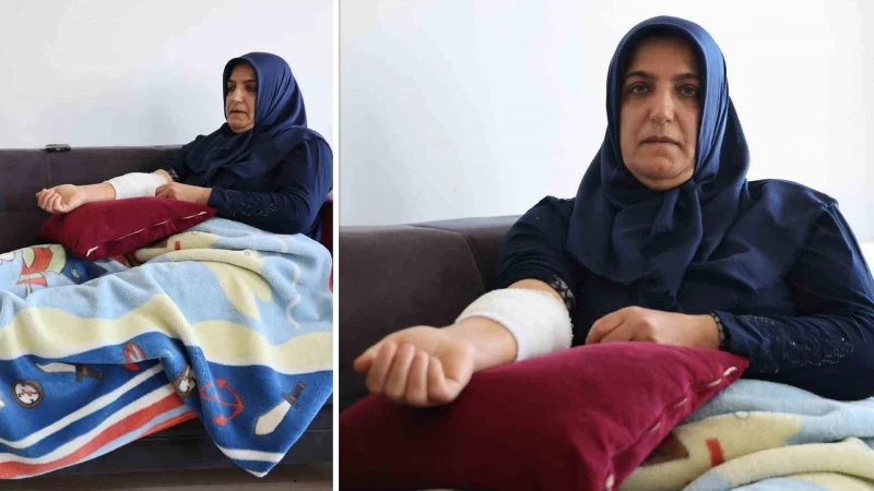 Otogarda köpek saldırısına uğrayan kadın canını zor kurtardı: 'Beni paramparça ederdi'