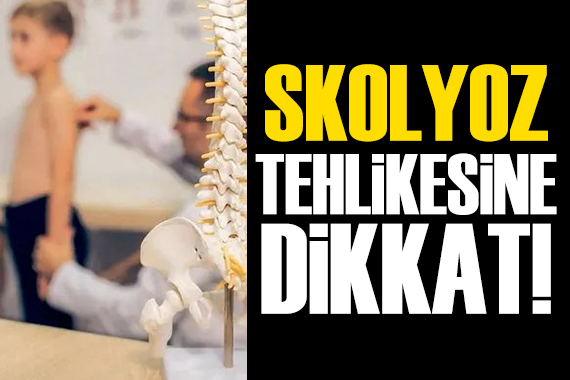 Ergenlerde skolyoz tehlikesine dikkat!