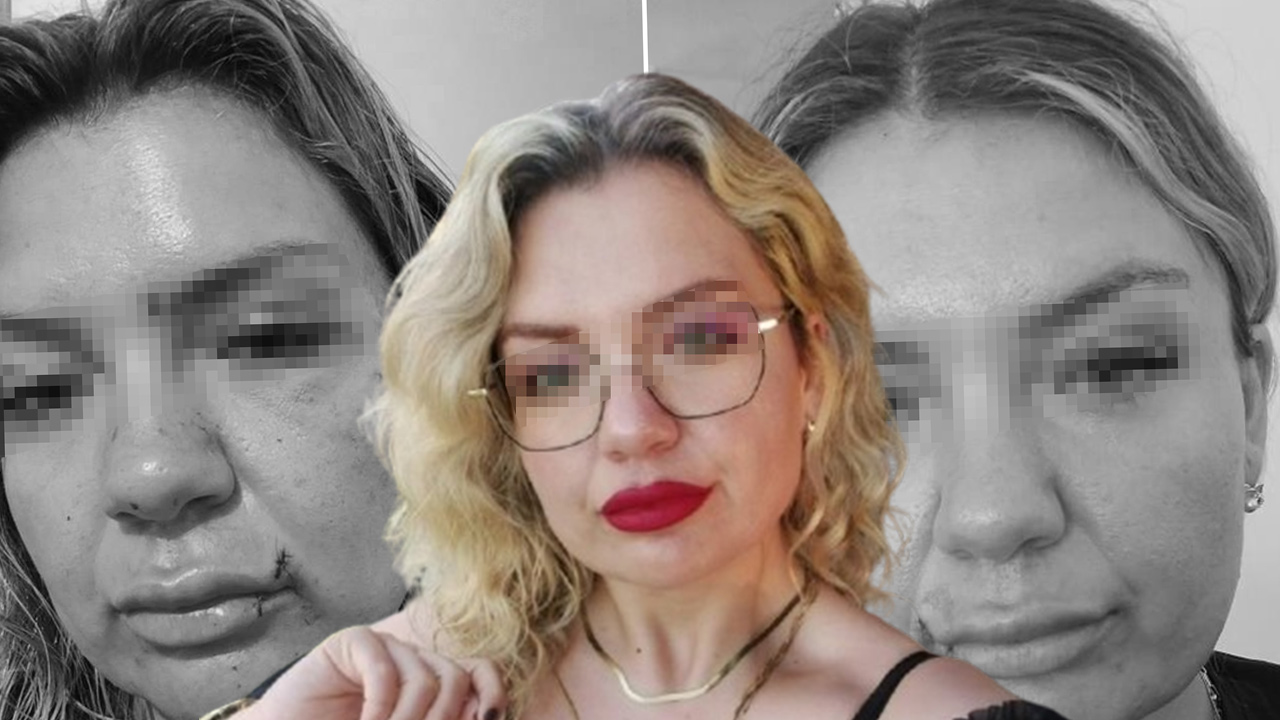 "Bugün büyük gün" diyerek aradı dehşeti yaşattı: Bıçak sırtında kırıldı