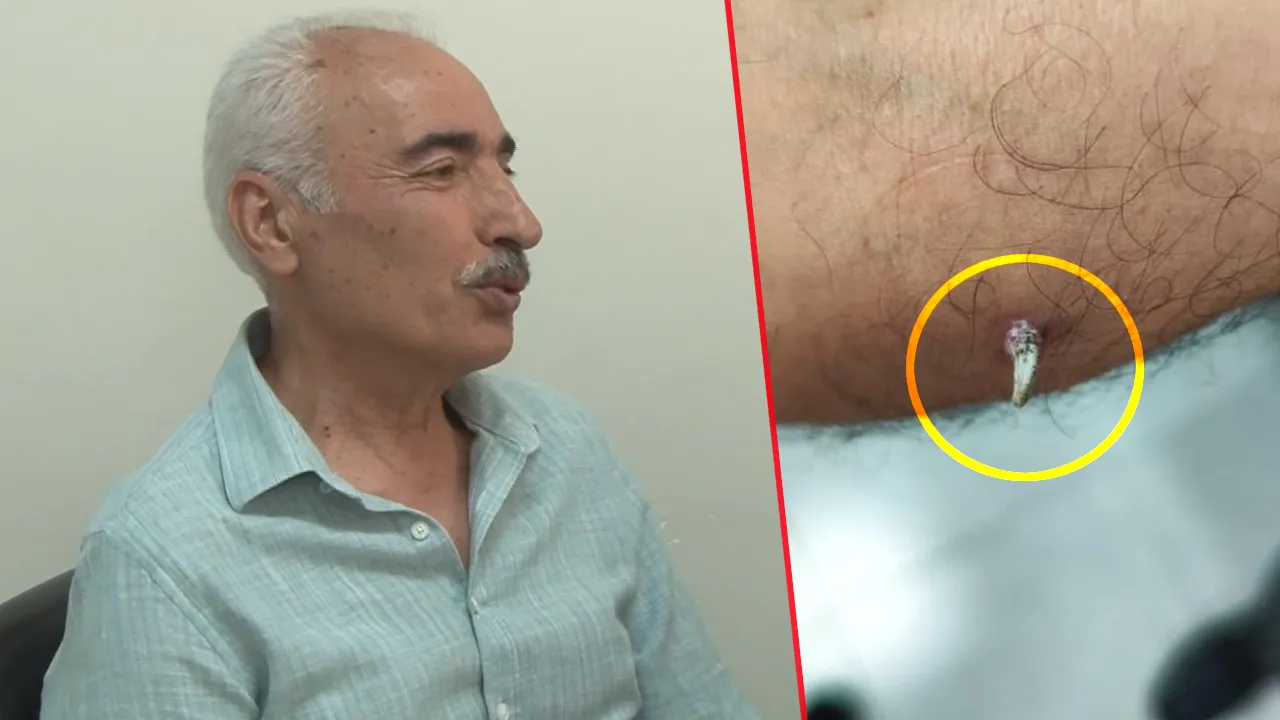 Kolundaki inatçı yarayla başvurdu… Gerçeği doktorda öğrendi