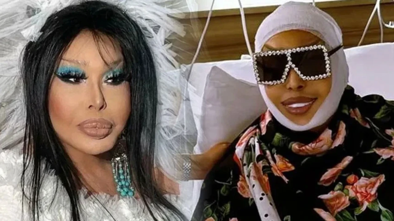Bülent Ersoy'dan 74 yaşında gençleşme operasyonu: "Biz starların yaşı yoktur..."