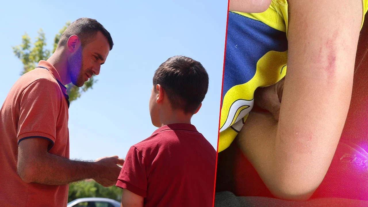 Konya'da Okul Çıkışında Skandal! Anne 10 Yaşındaki Çocuğu Darp Etti
