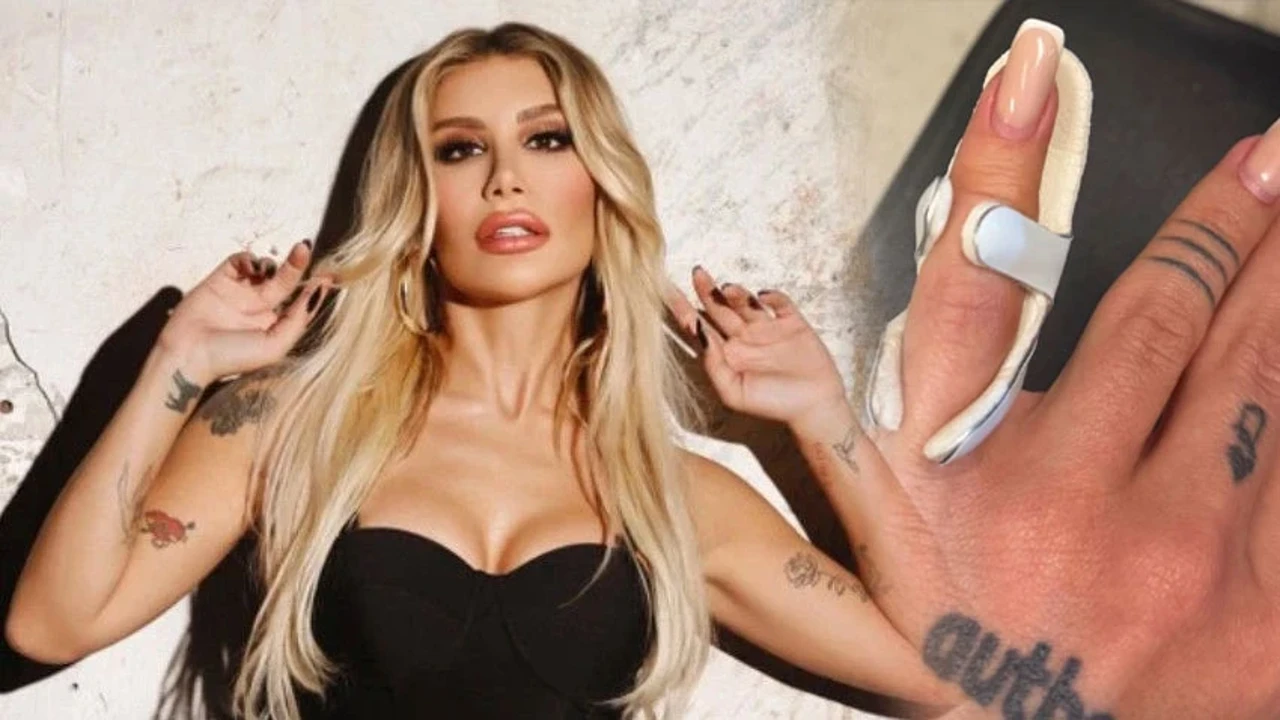 İrem Derici apar topar hastaneye gitti! Parmağındaki ağrının nedeni şaşırttı