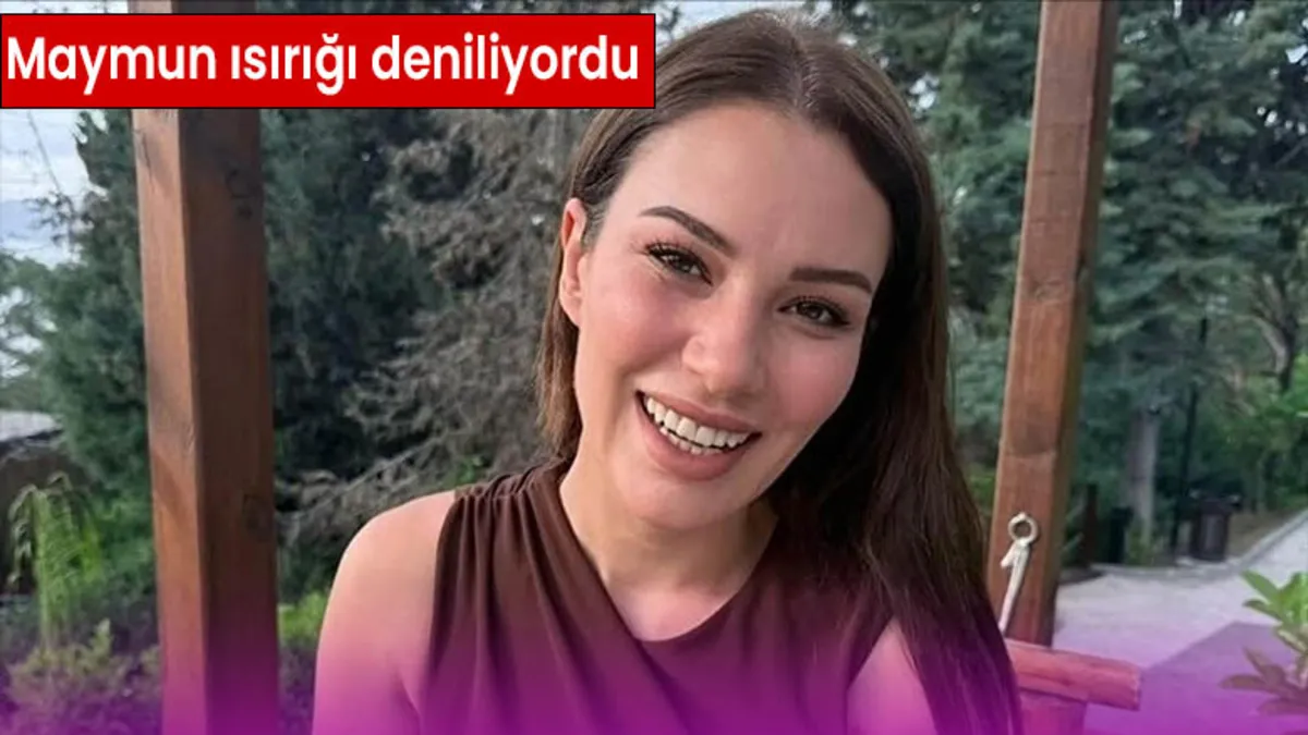 Oyuncu Ece İrtem'in ölüm nedeni belli oldu: Alkol zehirlenmesi