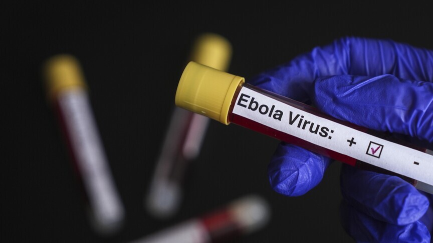 DSÖ: KDC'de Ebola salgınında durum ciddiyetini sürdürüyor