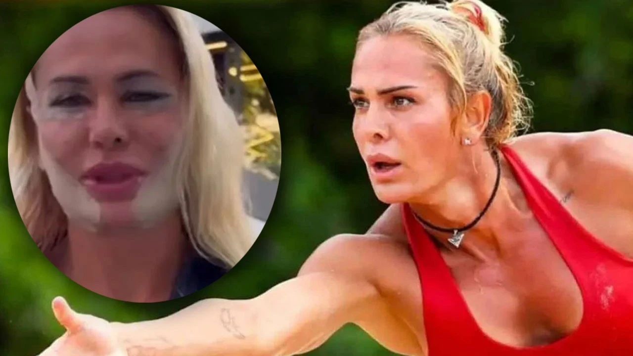 Survivor Nagihan estetik operasyonu geçirdi! Son hali şoke etti