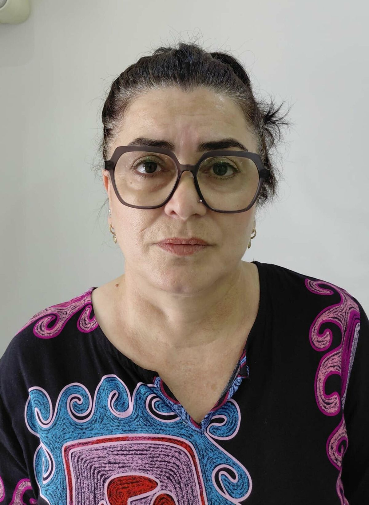 Ölümle biten kalça dolgusunda doktorun da aralarında olduğu 6 kişi için hapis istendi