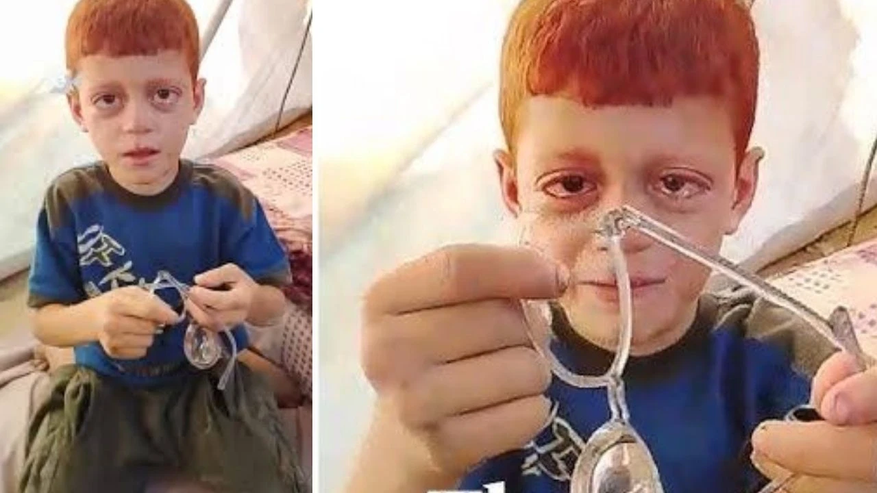 Kırılan gözlüğü için feryat etti, milyonları ağlattı